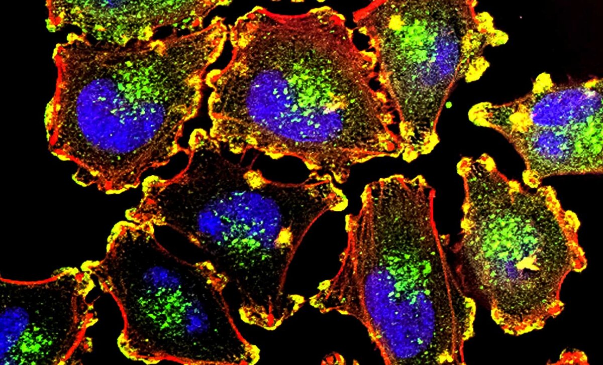 Источник изображения: Unsplash. Фотография National Cancer Institute