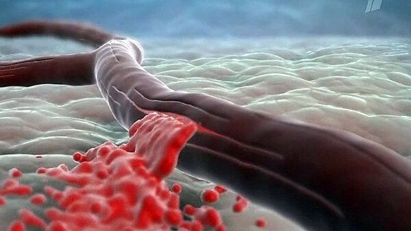 Постарался найти максимально нейтральную картинку, чтобы модераторы Дзена не обвинили меня в "шок-контенте".