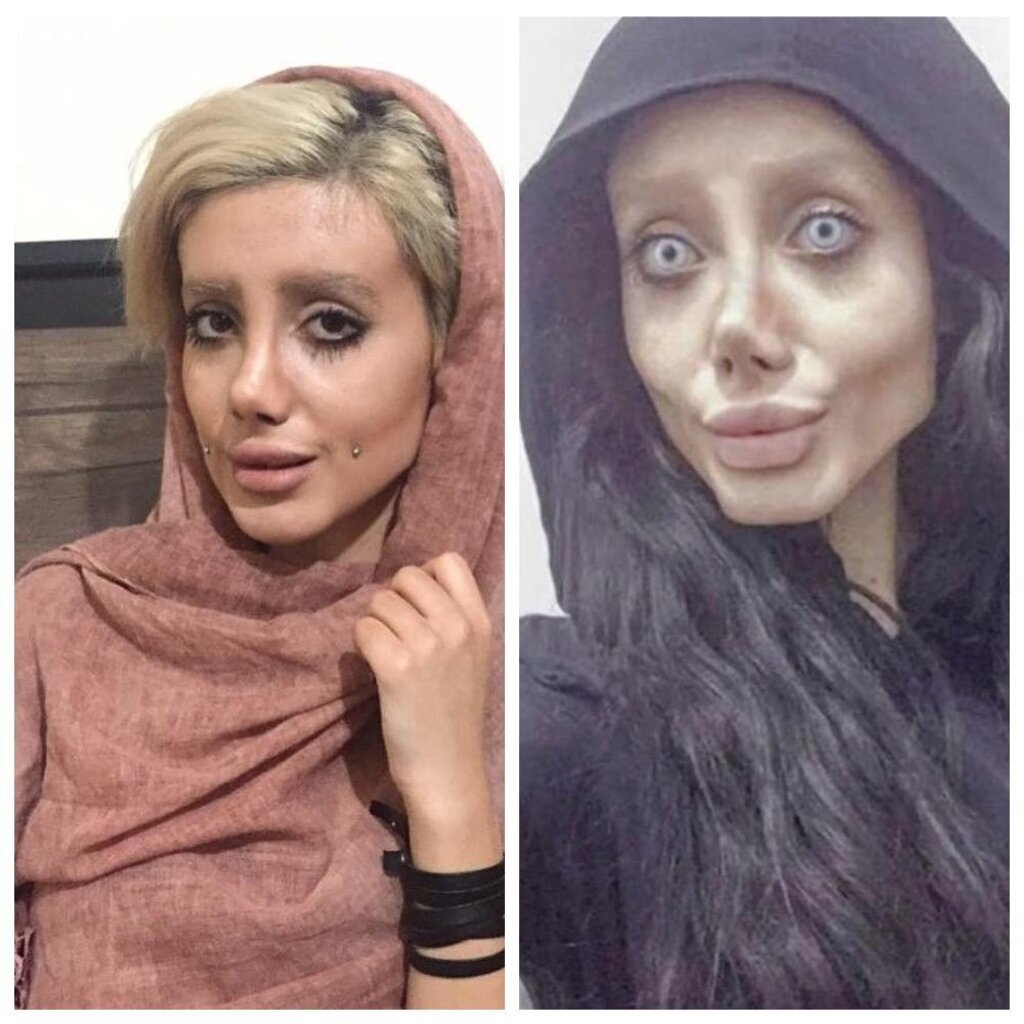 Фатима хишванд до пластики и после фото