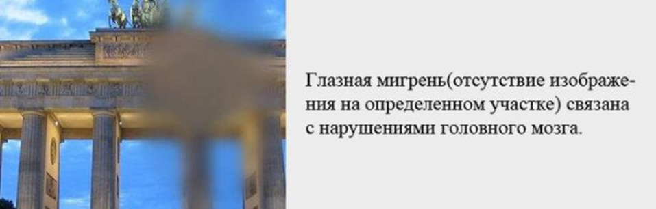 Мерцание в глазах сбоку