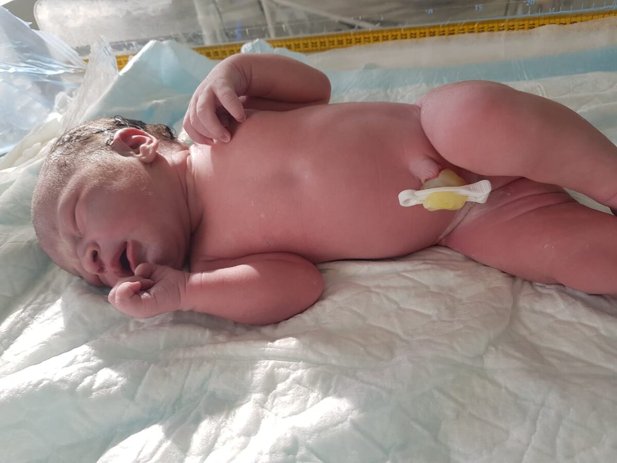 На фото не Серёжа, а Надюша, так как Сережины фото в архиве, а пишу на улице, с телефона. Тут 10 минут с момента рождения, фото неонатолога. 