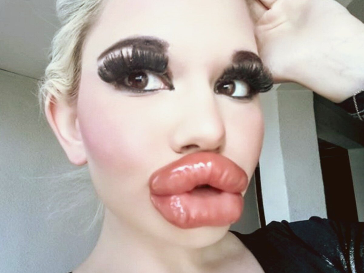 -3