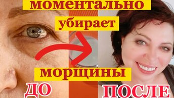 Просто УМЫВАЙТЕСЬ Этим!!!Мощный Концентрат МОЛОДОСТИ для Любой Кожи!ОМОЛОЖЕНИЕ,ПОДТЯЖКА,УВЛАЖНЕНИЕ!