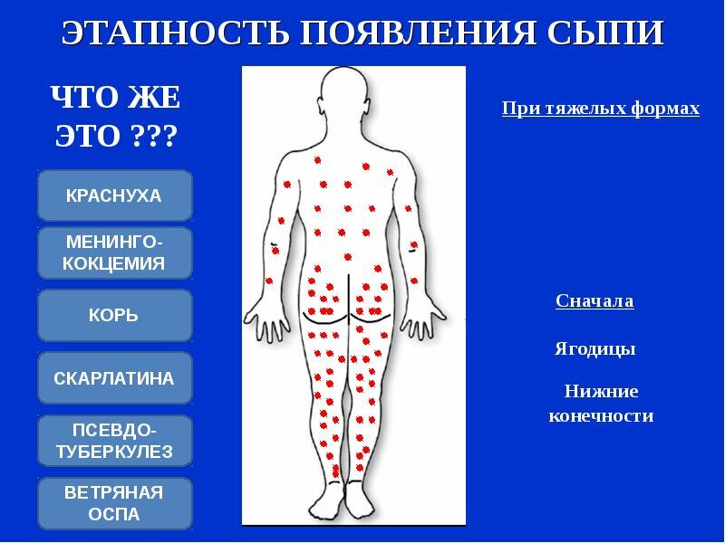 Сыпь у ребенка без температуры: почему появляется и что при этом делать