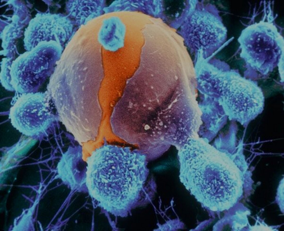 Атакующие клетки. Клетки иммунной системы фагоциты. Фагоцит микрофотография. Фагоцитоз раковых клеток. Макрофаг поглощает бактерии.