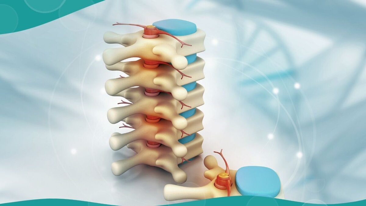 Межпозвоночный диск состоит из фиброзно-соединительной ткани. Внутри диска находится пульпа – желеобразная масса, окруженная фиброзным кольцом. Фото взято на сайте canva.com 