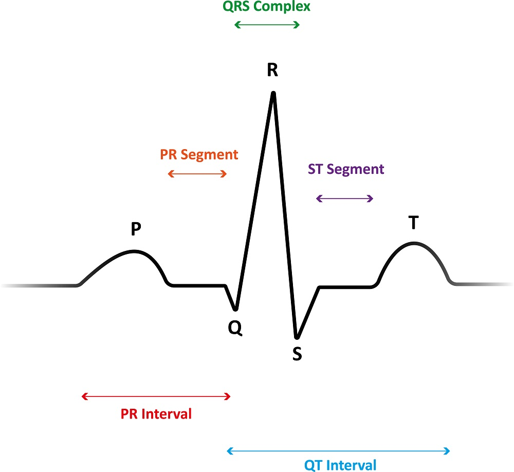 Экг человека. ЭКГ сердца QRS норма. Комплекс QRS на ЭКГ норма. ЭКГ схема зубцы. Комплекс PQRST на ЭКГ.