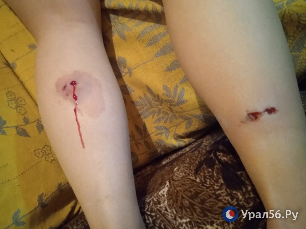    Сходила за хлебушком: Собака покусала жительницу Оренбурга, когда та шла в магазин