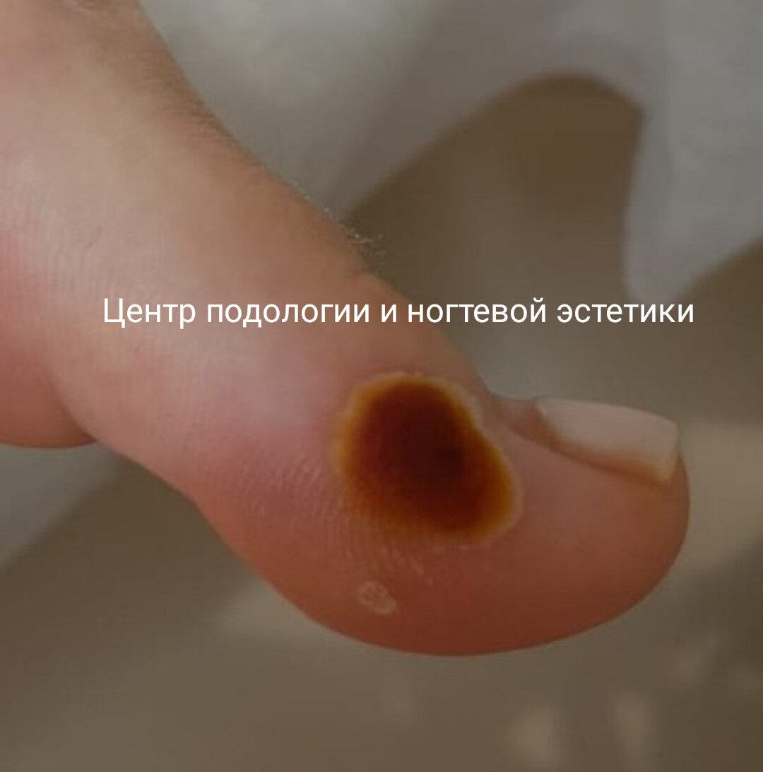 Второй приём.