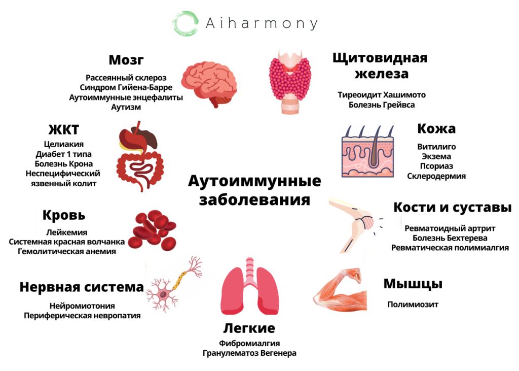 https://aiharmony.ru/autoimmunnye-zabolevaniya-statistika/