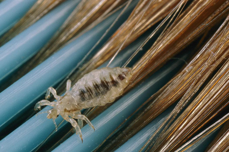 Вши у человека