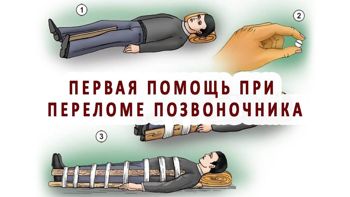 Перелом позвоночника первая помощь. Оказание 1 помощи при переломе позвоночника. Мотиватор при переломе. 1 Доврачебная помощь при остеохондрозе. Помощь перелом позвоночника реклама
