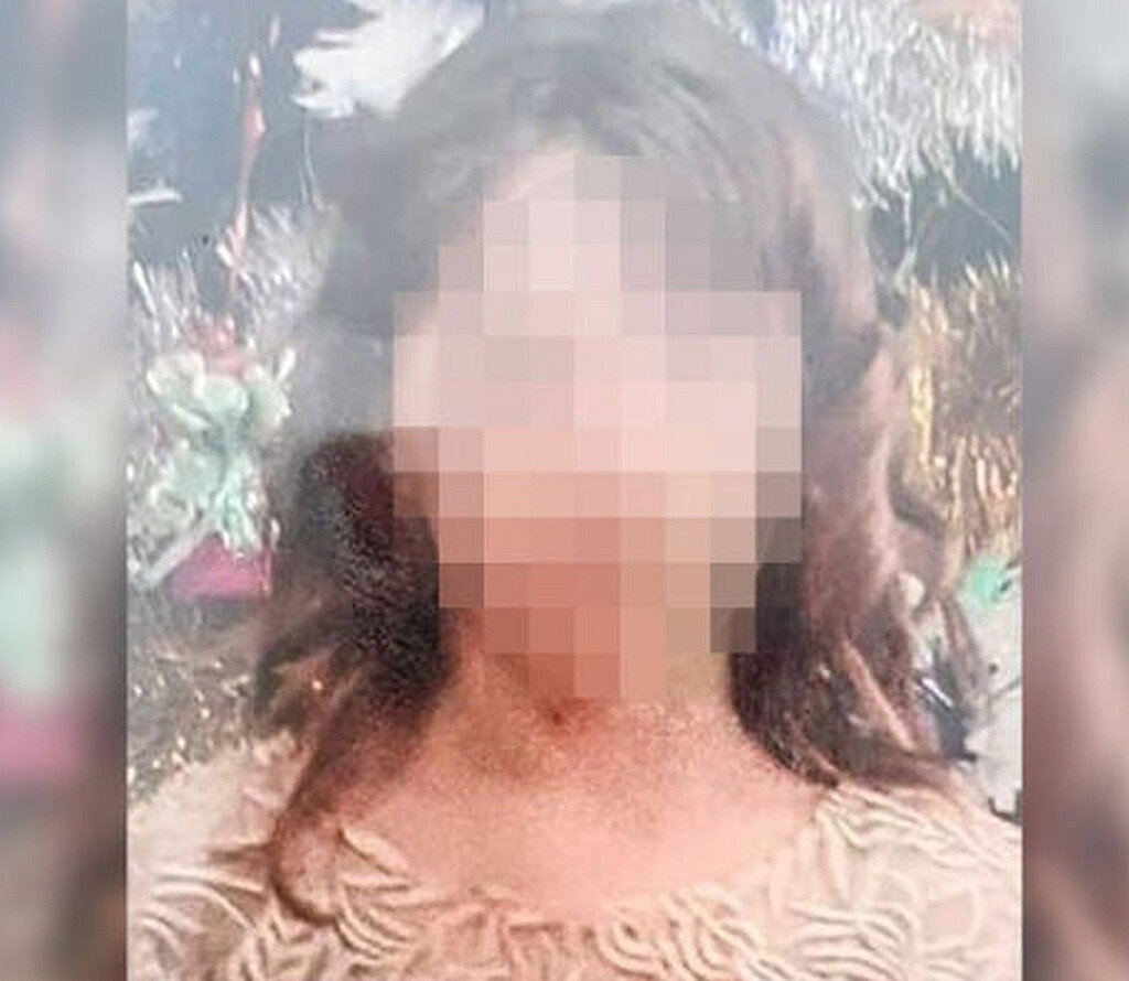 12-year-old Girl In Palawan Suffers From Overgrown Breasts