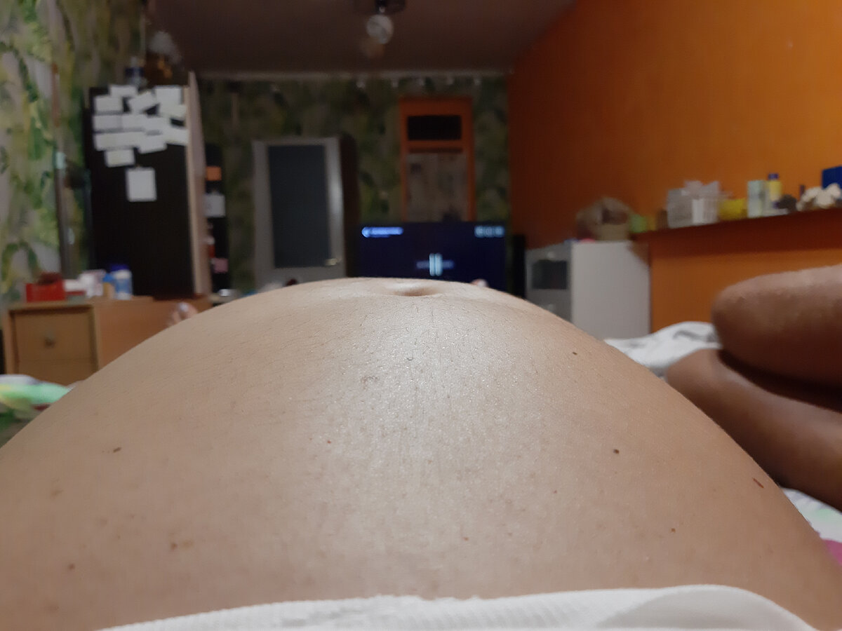 Живот с одного ракурса. Первое фото вечером, второе — утром следующего дня.