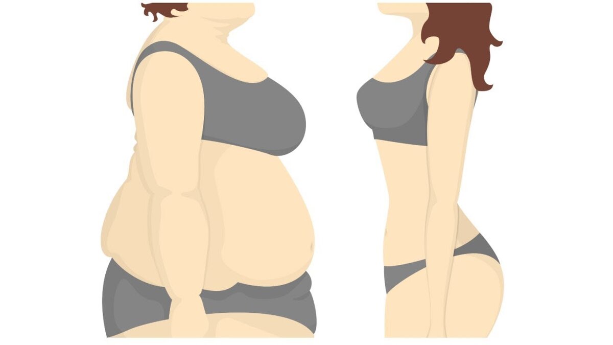 Ожирение и нормальный метаболизм наглядно