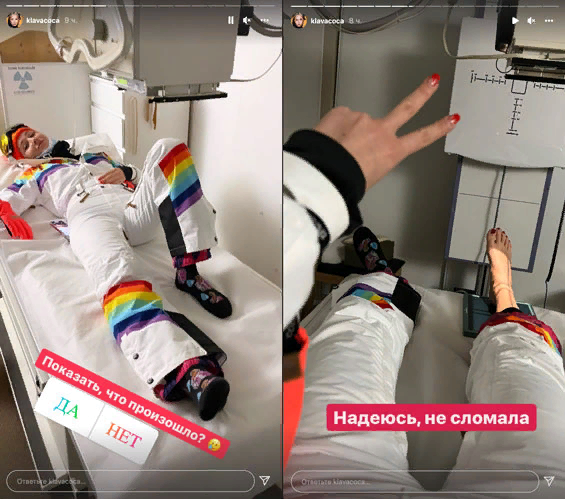 «Хух! Кости целы, а вот связки...» – подписала снимок артистка, затем добавила, что рентген ей обошёлся в 35 тысяч рублей.