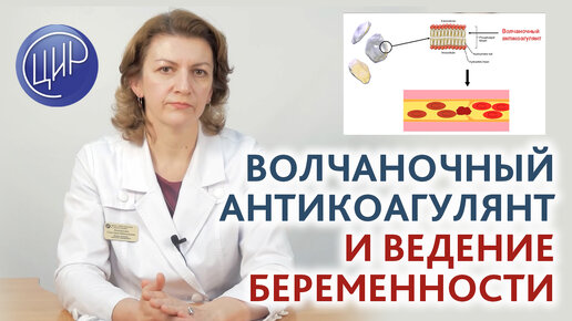 Волчаночный антикоагулянт при беременности: что это такое, чем он опасен и как выявляется. Рассказывает врач Дементьева С.Н.