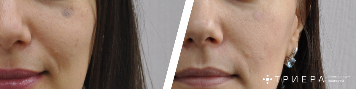 triera-clinic.ru