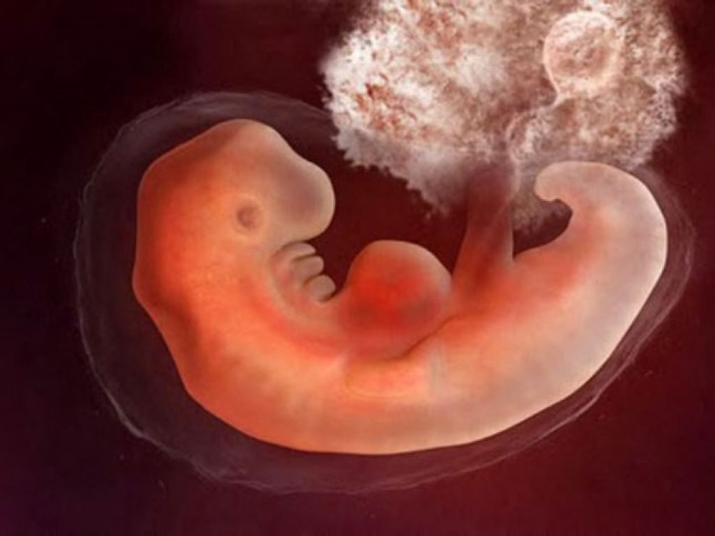 Плод 3-4 недели беременности. Эмбрион на 5 неделе беременности. Эмбрион выглядит 4 недели. Как выглядит эмбрион в 4 недели.