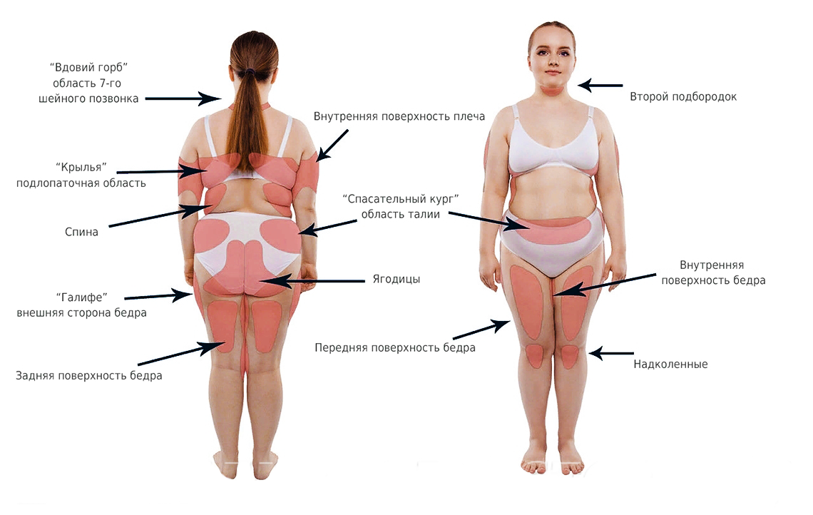 Проблемные зоны женской фигуры названия на рисунке