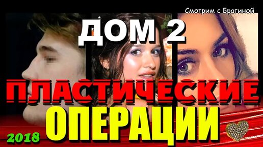 Самые странные пластические операции участников «Дома-2»