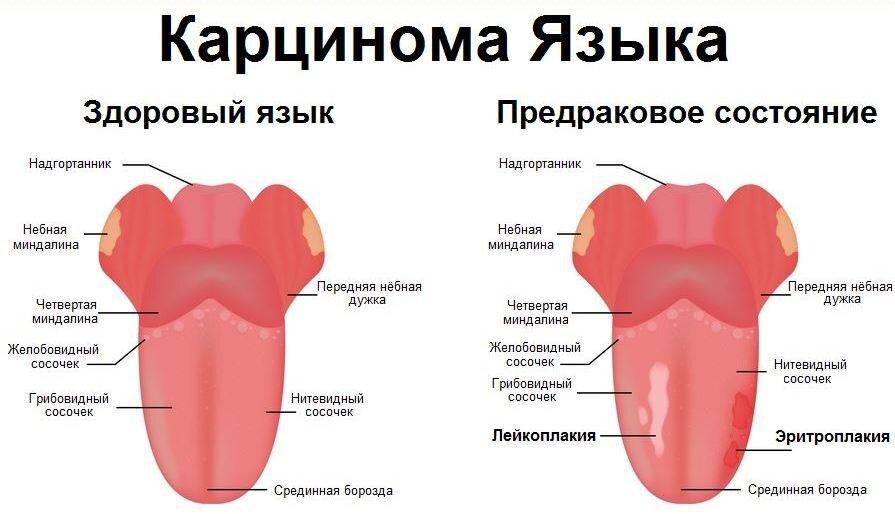 Язык - зеркало желудка, и не только