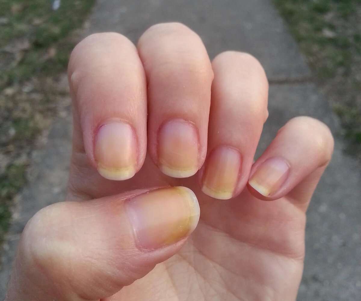     «Нюд, вернись»: что делать, если пожелтели ногти