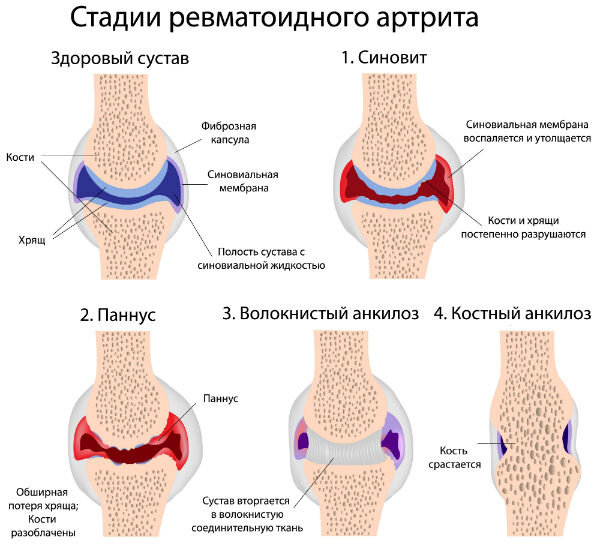 Витамины для костей и суставов