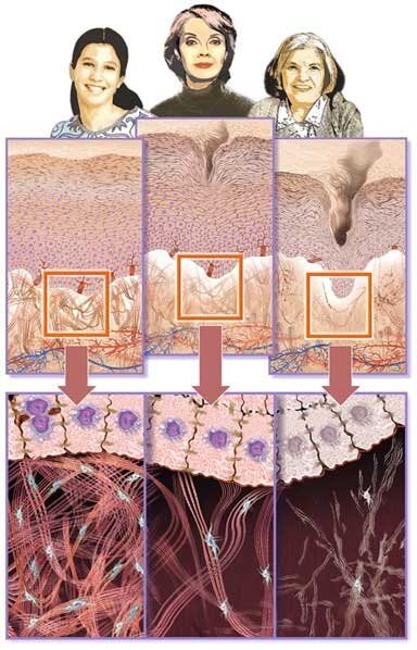 Гликирование кожи