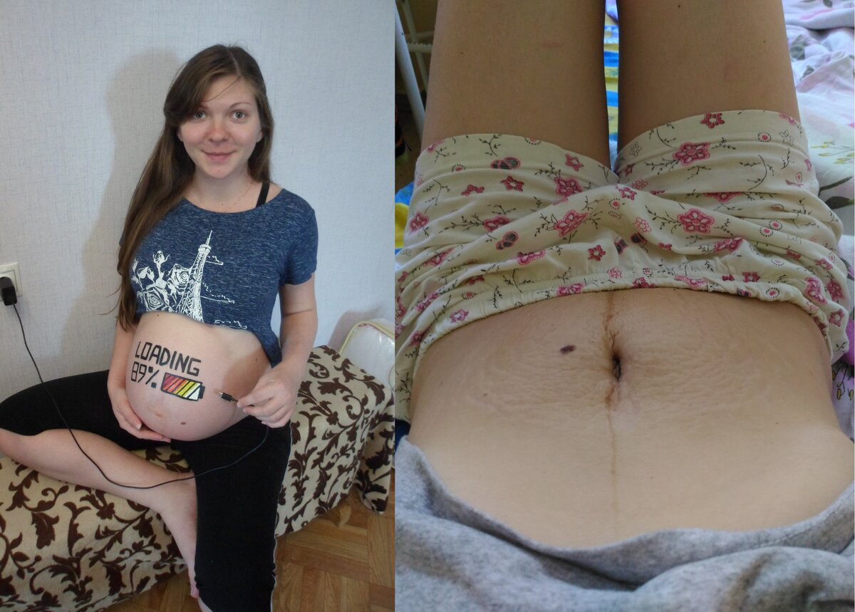 До и после родов. Разница очевидна. Фото: личный архив