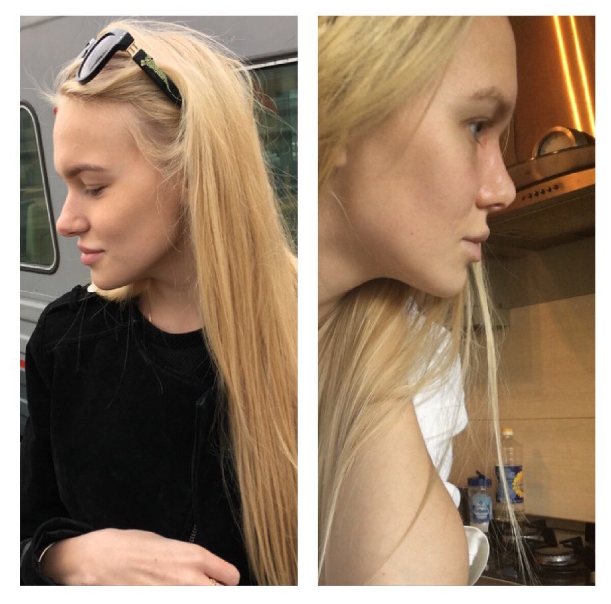 1 -свой нос 2-только что сделанный, к сожалению, по каким-то причинам он потом увеличился 