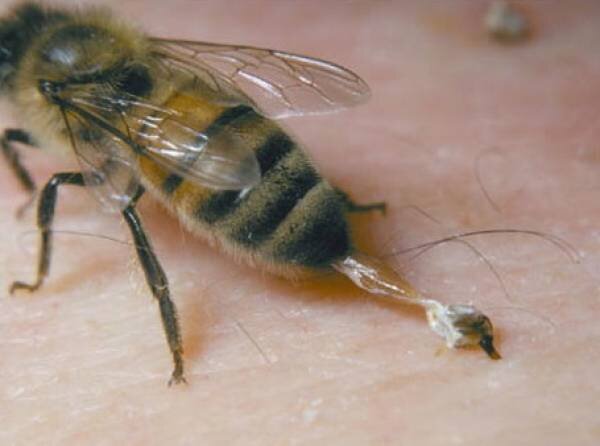 Пчела отрывает жало.