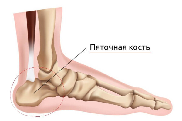  Остеохондроз пяточной кости – разве так бывает? Остеохондроз позвоночника, нежно любимый  пациентами и врачами – болезнь известная, а вот про эту патологию мало кто знает.-2