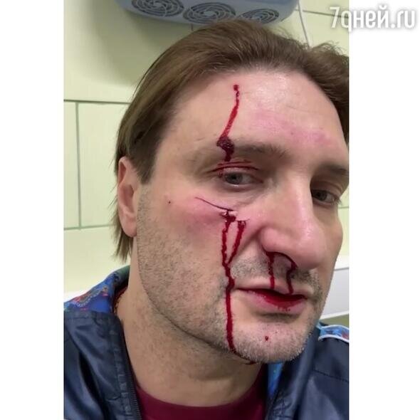    Эдгард Запашный Социальные сети