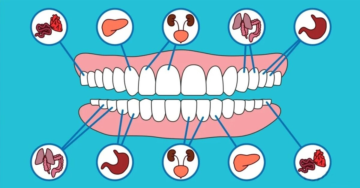 Связь зубов с органами. Заболевания зубов дёсен и ротовой полости. Зубы и внутренние органы. Связь зубов и органов. Зубы и органы взаимосвязь.