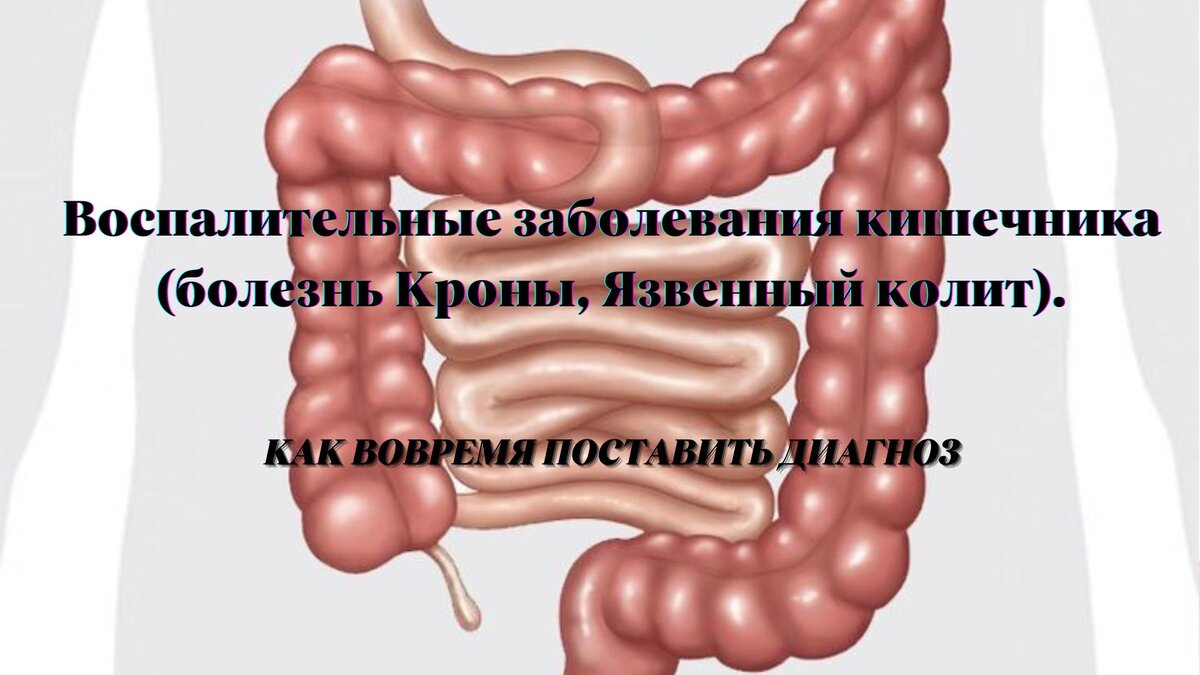 Диагноз стул с кровью