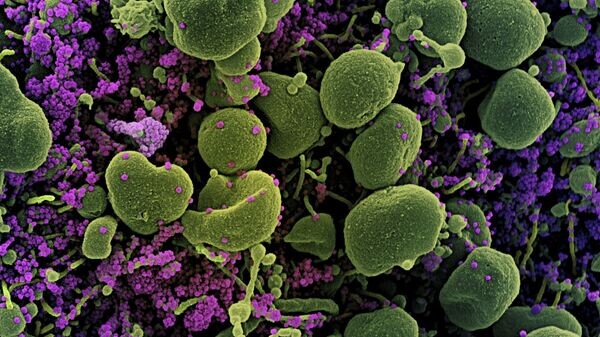   © AFP 2022 / US NATIONAL INSTITUTE OF ALLERGY AND INFECTIOUS DISEASES