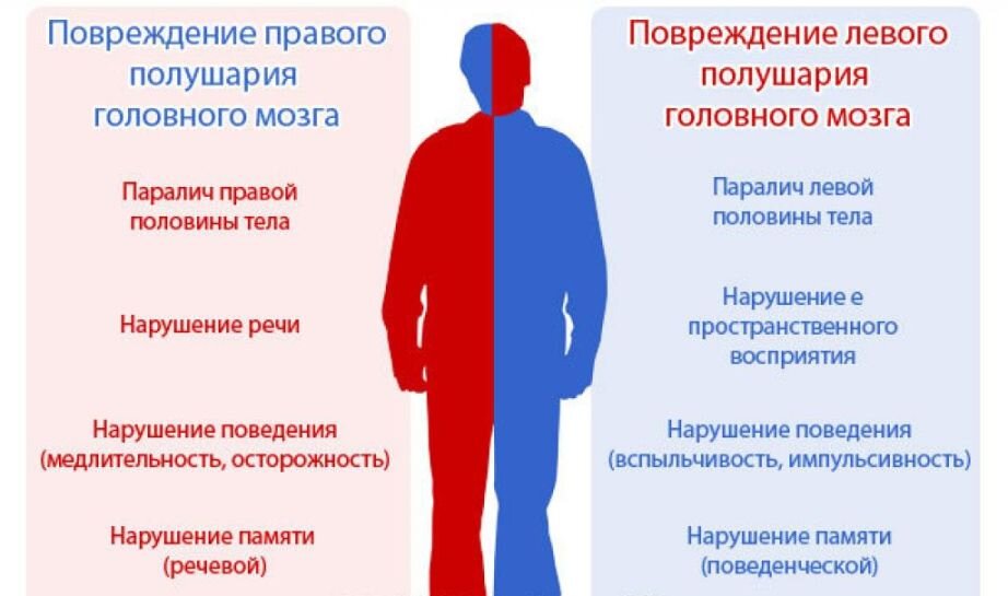 Восстановление речи после инсульта - упражнения в домашних условиях