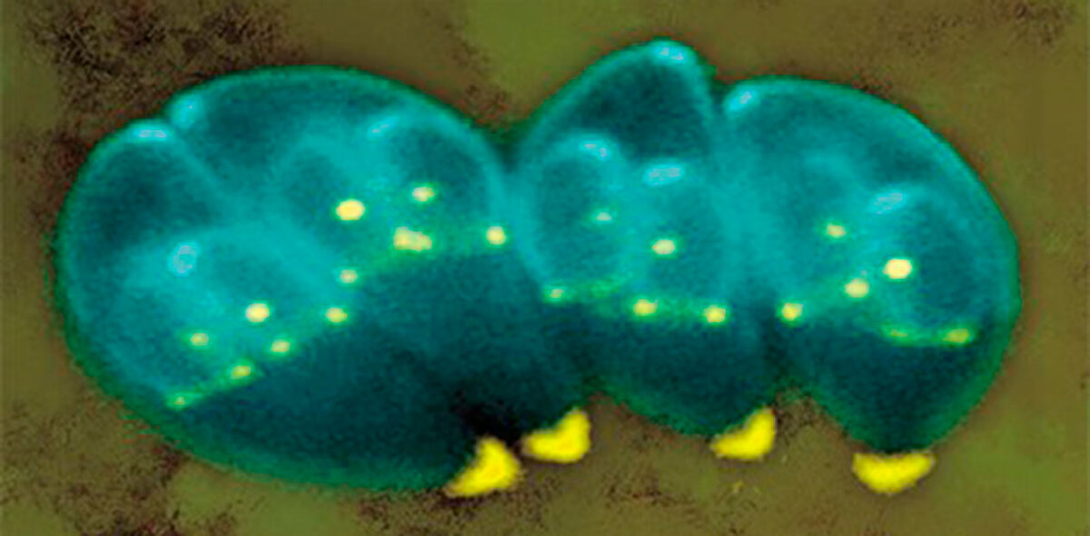 Этап размножения токсоплазмы (Toxoplasma gondii) – формирование внутри материнских клеток цитоскелетных каркасов дочерних клеток (зеленым цветом помечен белок микротрубочек). © Ke Hu and John M. Murray