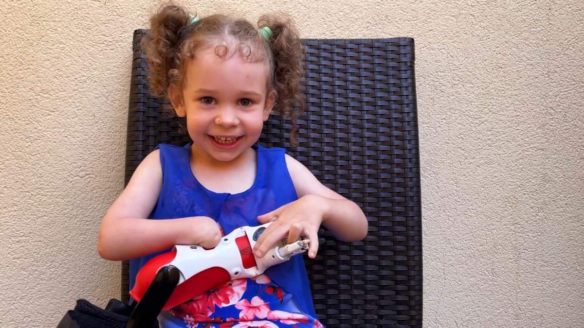 Аплазия – не приговор. Это отличие, которое Моторика поможет превратить в суперсилу 