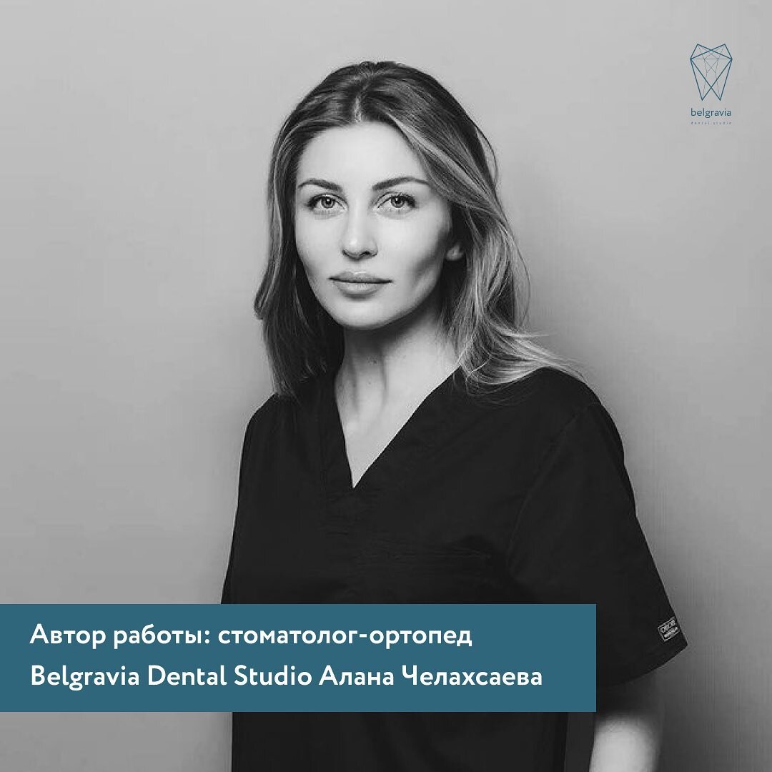 Керамические коронки: все тонкости | Стоматология Belgravia Dental Studio |  Дзен