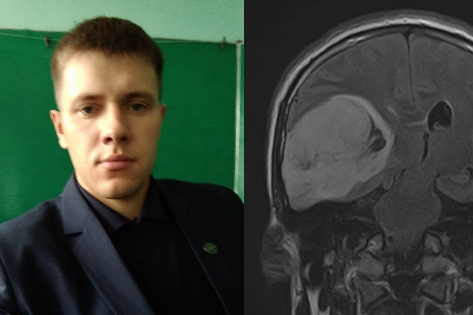     Алексей вел здоровый образ жизни и жал 200 кг от груди. Фото: Предоставлены Алексеем Кузнецовым // пресс-служба НИИТО имени Цивьяна