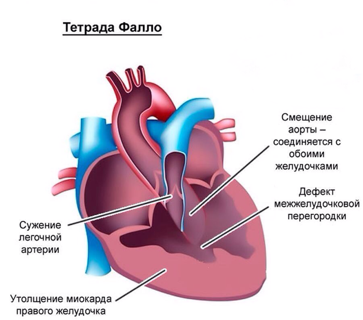 Зондирование полостей сердца