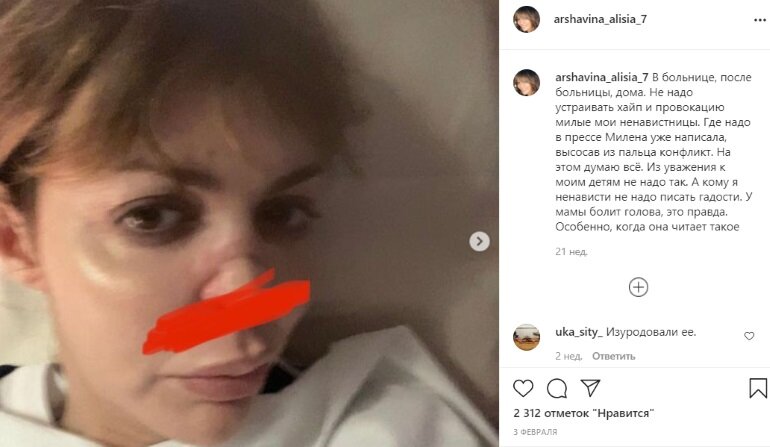 Алиса аршавина без носа фото