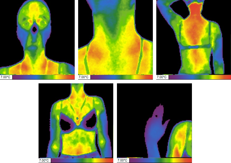 Данные термографии