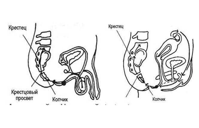 Схема, помогающая концентрировать внимание на "внутренних ощущениях"