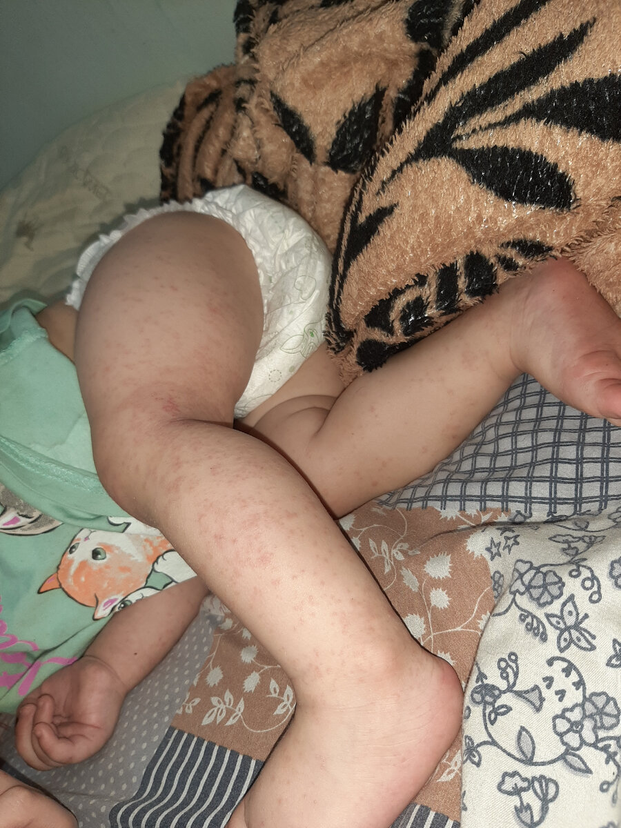 вот такое было все тело