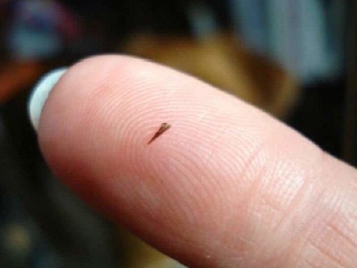 Фото Заноза в пальце.