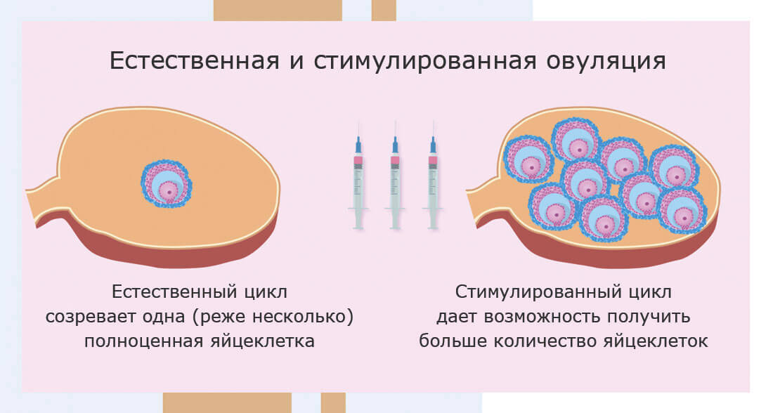 Естественная и стимулированная овуляция