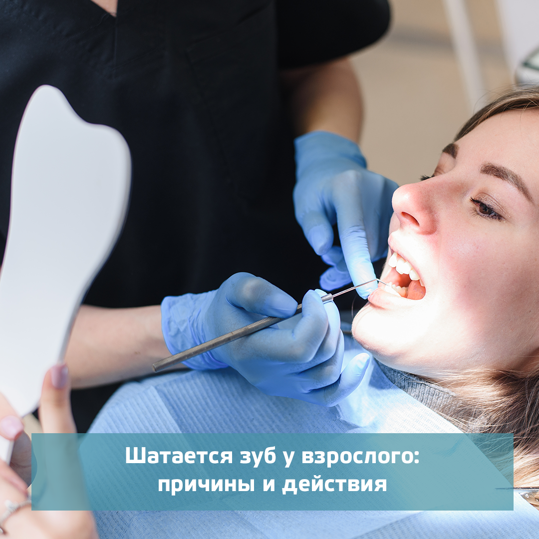 Сильно шатается зуб. Стоматолог. Зубы стоматолог. Сайт стоматологии.